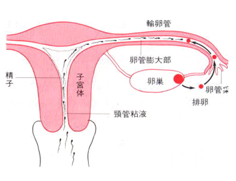 输卵管堵塞